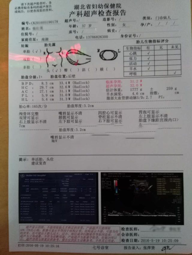 ���ݴ���